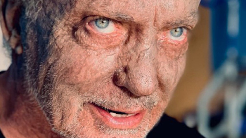 Lillebror bliver til Storebror i Riget