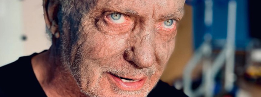 Lillebror bliver til Storebror i Riget