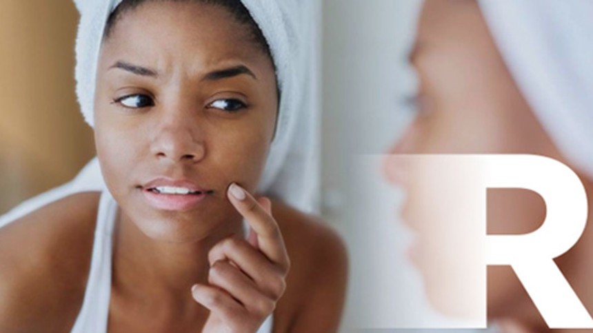 Sådan kommer du akne og akne ar til livs