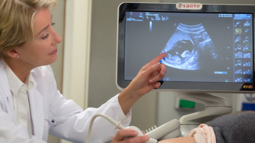 Bridget Jones’ baby