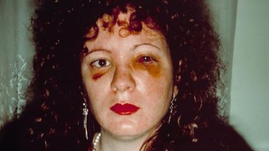 All the Beauty and the Bloodshed