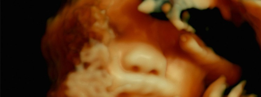 De humani corporis fabrica